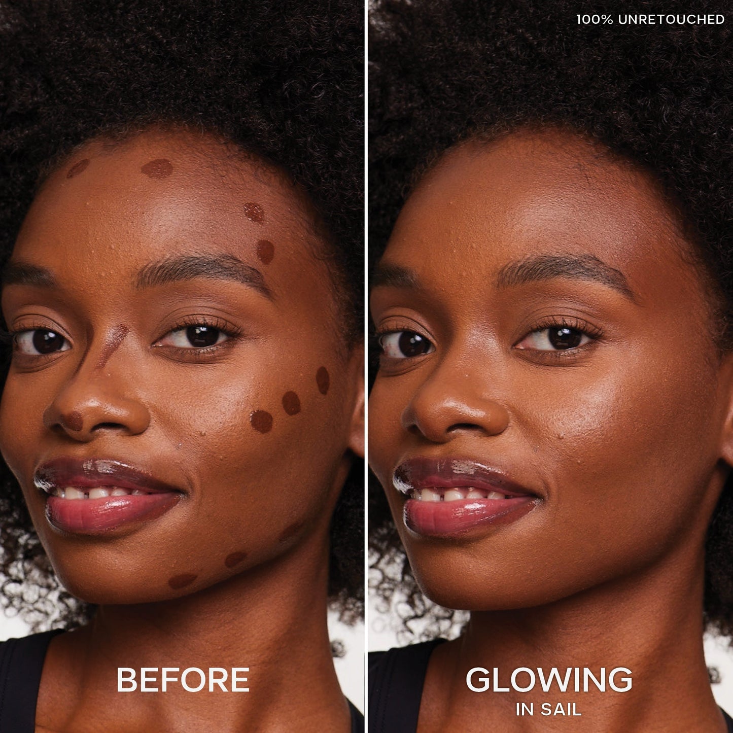 Dew Bronze™ Duo