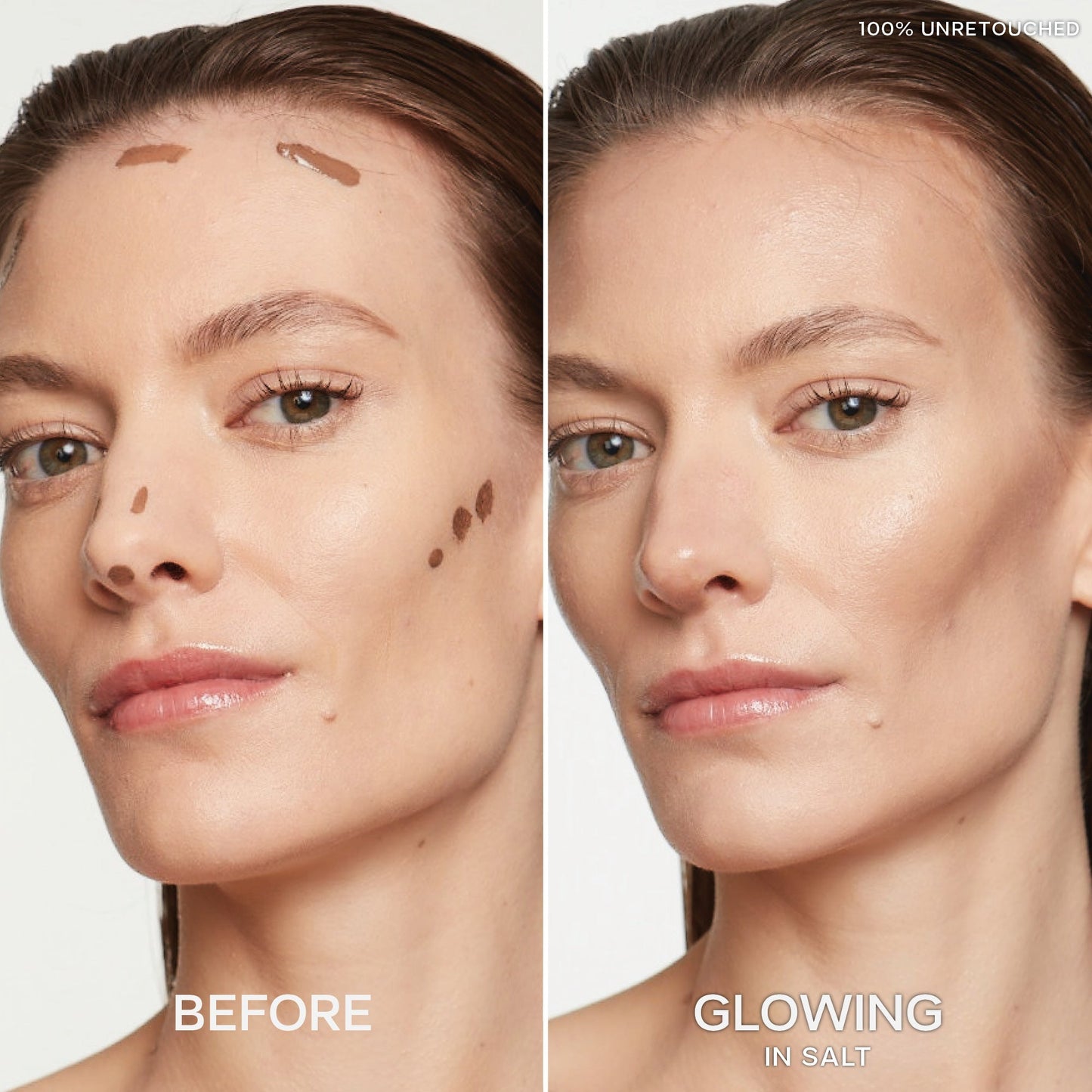 Dew Bronze™ Duo